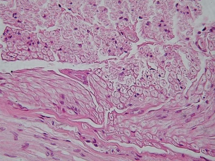 Figure 4 — Histologic section of nervous tissue on H&E. Note the overall organization of the nervous tissue, the presence of nervous cells, and the surrounding support component.